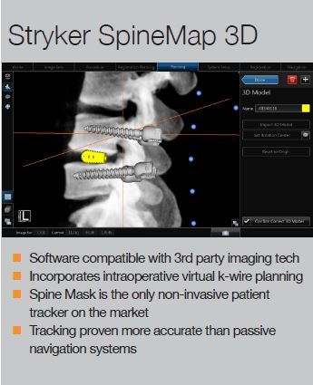Stryker SpineMap 3D fact box