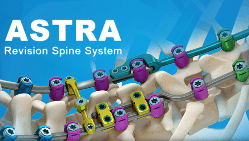 SpineCraft Astra