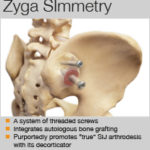 Zyga SImmetry summary box Mar 16