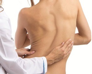 scoliosis_featured