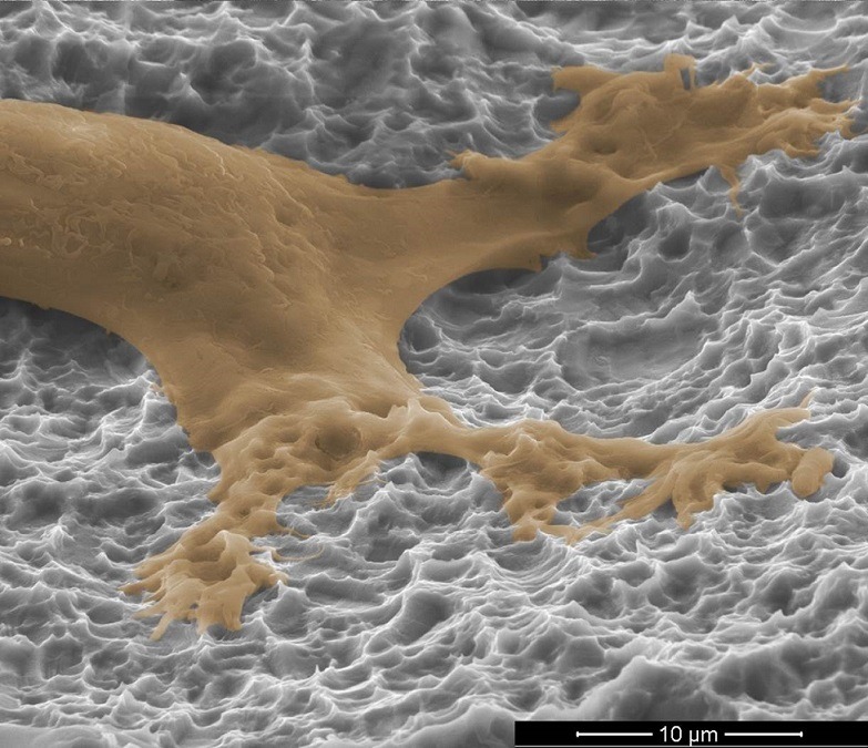 Titan Spine's Nanolock surface up close