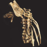 Selam, Ethiopia, 12 thoracic vertebrae