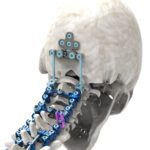 Astura Medical Skull Image