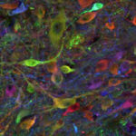 stem cell derived neurons 640×400